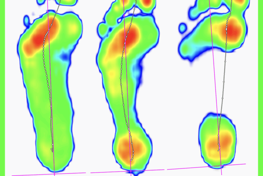 Gait Analysis Assessment